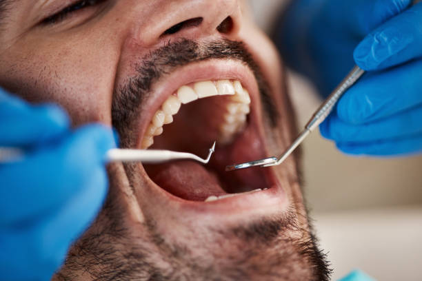 Best Knocked-Out Tooth Emergency  in Judson, SC