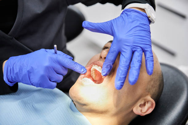 Best Urgent Tooth Repair  in Judson, SC